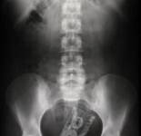 Необычные рентгеновские снимки (14 фото)